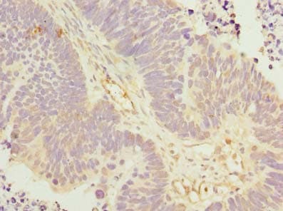 KLHL42 / KLHDC5 Antibody