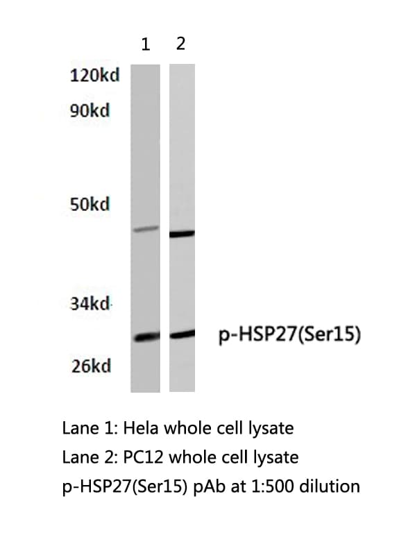 Polyclonal Rabbit anti-Human HSPB1 / HSP27 Antibody (phospho-Ser15, WB)