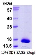 Human TXNDC17 Protein (Recombinant His)