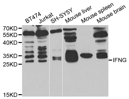 Polyclonal Rabbit anti-Human IFN Gamma / Interferon Gamma Antibody (IHC, WB)