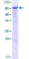 Human ANKHD1 Protein (Recombinant GST)