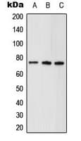 ALDP / ABCD1 Antibody (Internal)