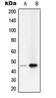 Polyclonal Rabbit anti-Human SERPINB2 / PAI-2 Antibody (Internal, WB)