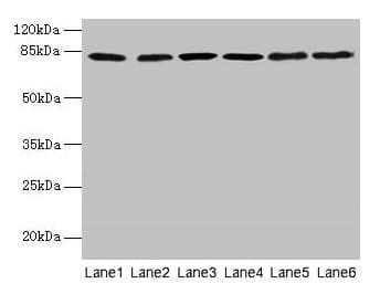 Polyclonal Rabbit anti-Human CAPN1 / Calpain 1 Antibody (aa1-714)