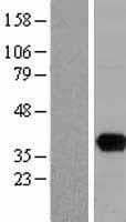 UNG / Uracil DNA Glycosylase Protein (Over-Expression Lysate Myc-DDK (Flag))