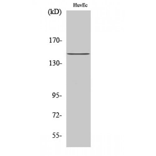 Polyclonal Rabbit anti-Human INPP5D / SHIP1 / SHIP Antibody (1110-1190 aa, C-terminal, WB)