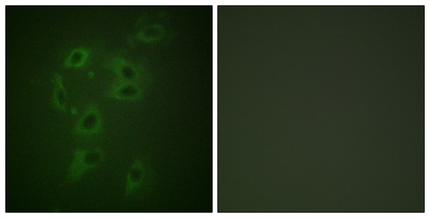 c-CBL Antibody (phospho-Tyr700)