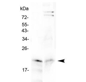 Polyclonal Rabbit anti-Human CYGB / Cytoglobin Antibody (IHC, WB)