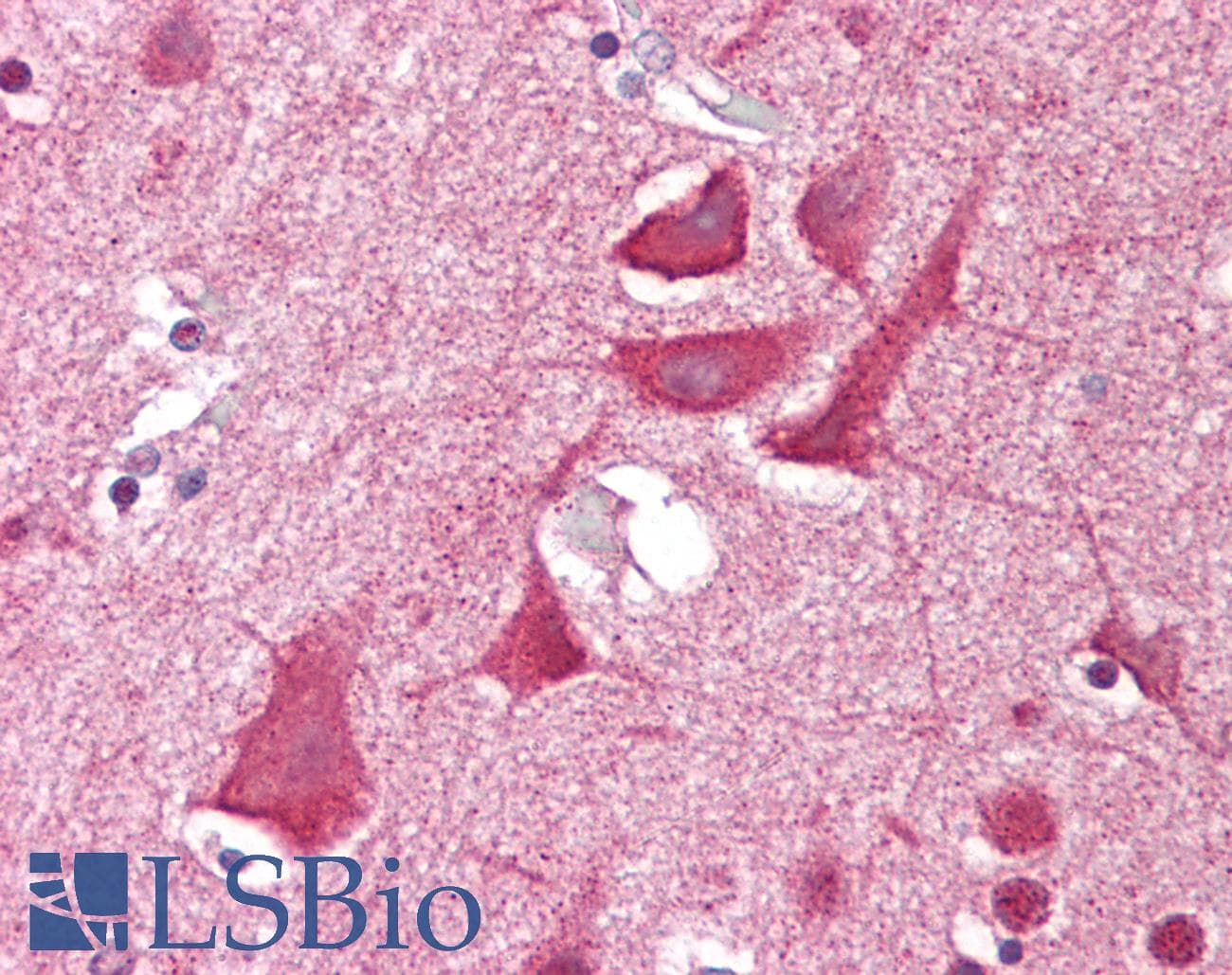 IHC-plus™ NKX3-2 / BAPX1 Antibody