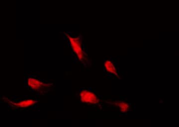 HDAC4 Antibody (phospho-Ser632)