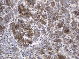 c-Kit / CD117 Antibody (clone OTI2E3)