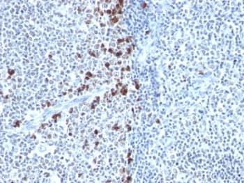 Mouse Anti-Human Kappa Light Chain Secondary Antibody (clone HP6053, Ready-to-Use)