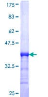 Human TADA2B Protein (Recombinant GST, N-terminus)