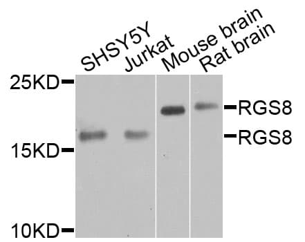 Polyclonal Rabbit anti-Human RGS8 Antibody (WB)