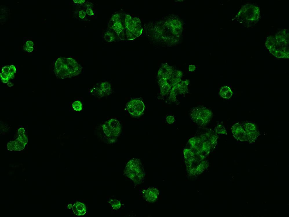 AMH / Anti-Mullerian Hormone Antibody (aa25-560, Preservative Free)