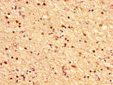 CRYAB / Alpha B Crystallin Antibody (aa1-175)