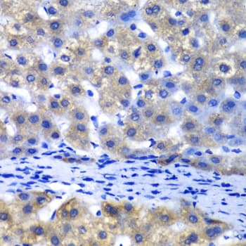 PSMD8 / RPN12 Antibody
