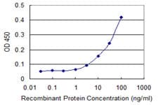 IHC-plus™ SNAPIN Antibody (clone 3H1)