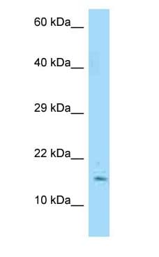 Polyclonal Rabbit anti-Human MYDGF / SF20 Antibody (N-Terminus, WB)