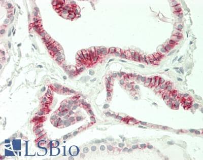 PathPlus™ CDH16 / Cadherin 16 Antibody (clone CDH16/1071)