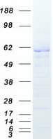 Human XIAP Protein (Recombinant Myc-DDK (Flag))