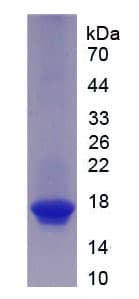 Mouse ACTRIIB / ACVR2B Protein (Recombinant His)