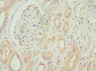 Polyclonal Rabbit anti-Human EMP1 Antibody (IHC)