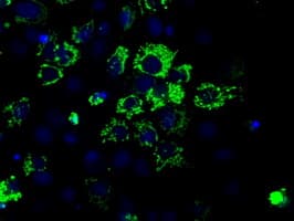 Monoclonal Mouse anti-Human ACO2 / Aconitase 2 Antibody (clone OTI7A11, IF, WB)