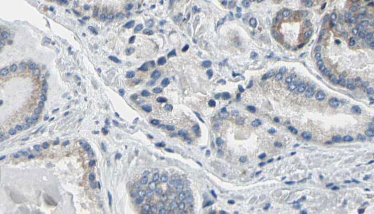 Polyclonal Rabbit anti-Human RPL36 / Ribosomal Protein L36 Antibody (IHC, IF, WB)