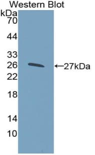 NOTCH2 Antibody (aa2251-2466)