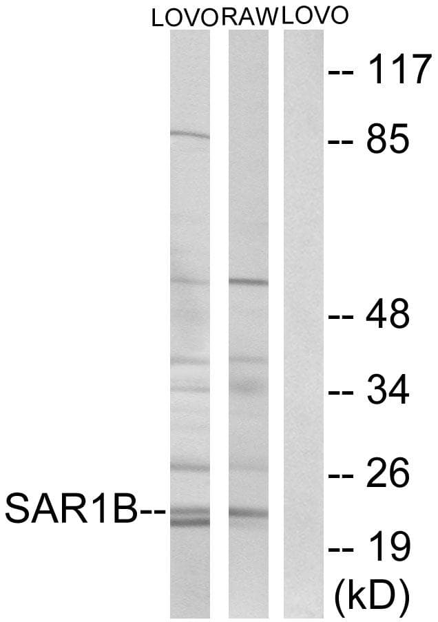SARA2 / SAR1B Antibody