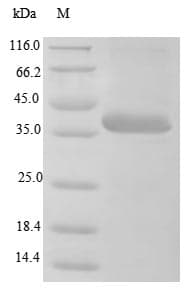 BK Polyomavirus Minor Capsid Protein VP2 (Recombinant 10His, N-terminus)