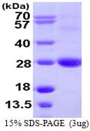 Human ARL11 Protein (Recombinant His)