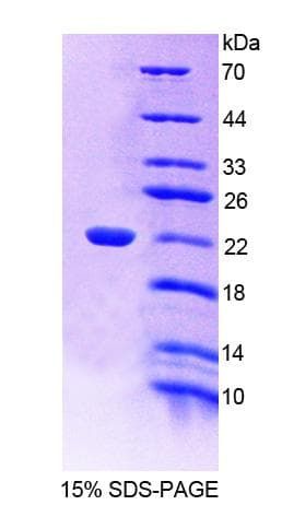 Human EDF1 / MBF1 Protein (Recombinant His-T7)