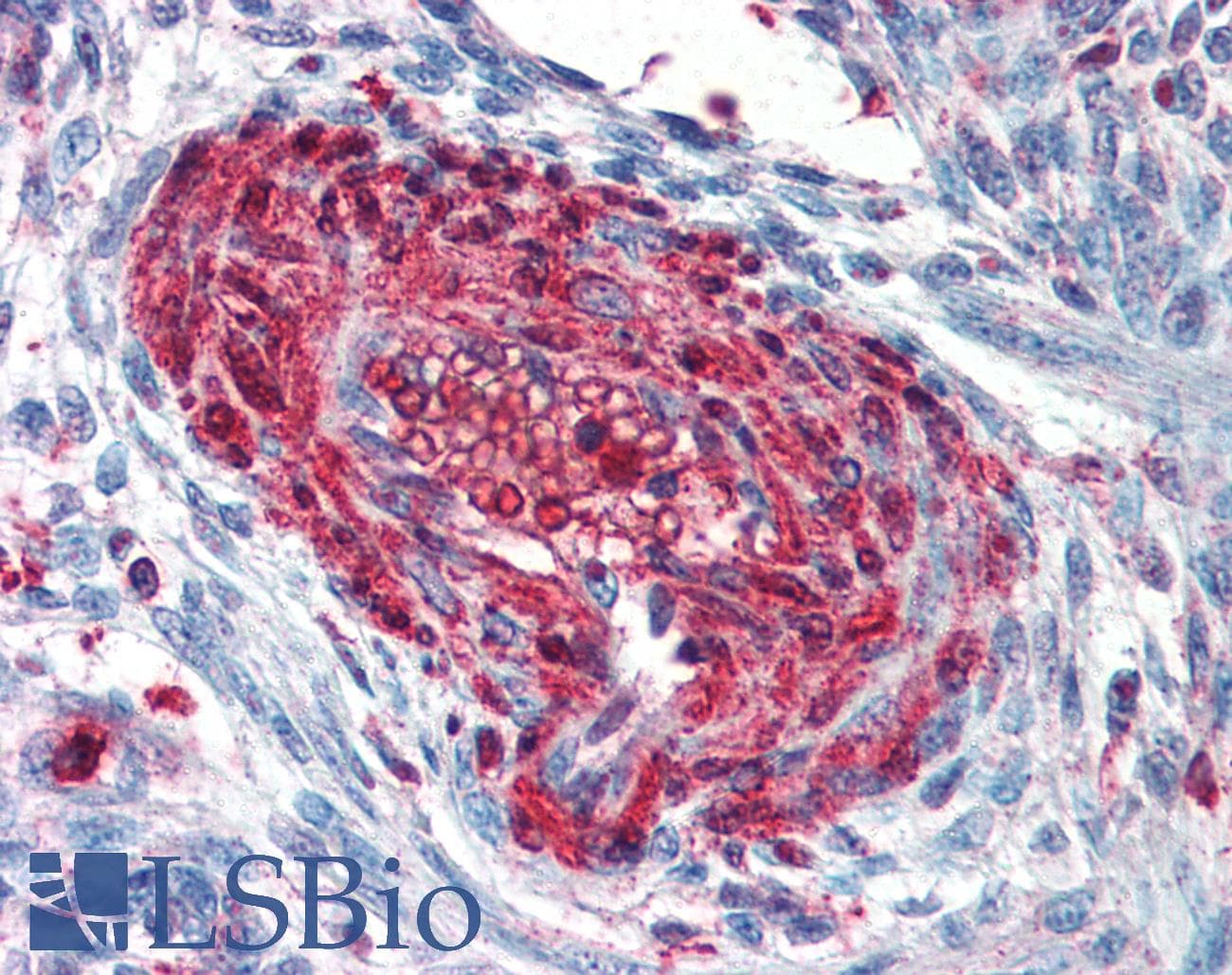 PathPlus™ Polyclonal Goat anti-Human S100A4 / FSP1 Antibody (aa80-C-term, IHC, WB)