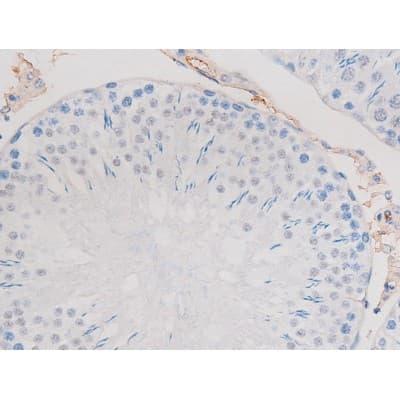 ADD1 / Adducin Alpha Antibody (phospho-Ser726)