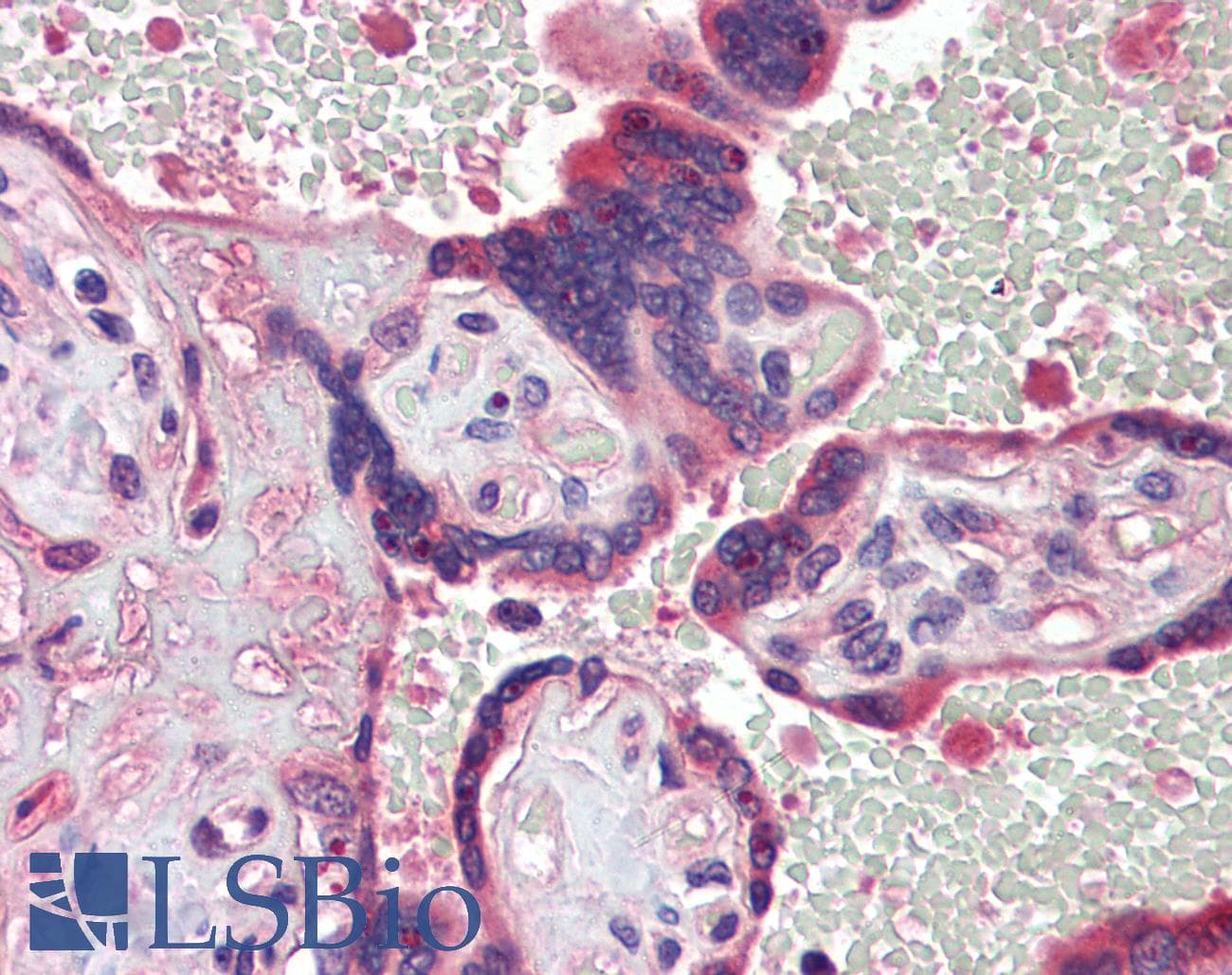 IHC-plus™ TDP1 Antibody (clone AT1F2)