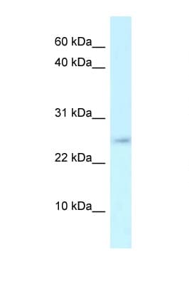 Polyclonal Rabbit anti-Mouse RCS / ARPP-21 Antibody (N-Terminus, WB)