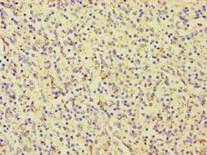 Polyclonal Rabbit anti-Human CARD9 Antibody (aa237-536, IHC, WB)
