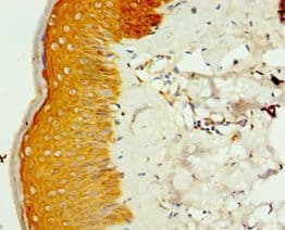 SMYD4 Antibody (aa1-260)