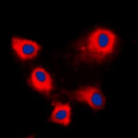 ARFIP1 Antibody (C-Terminus)
