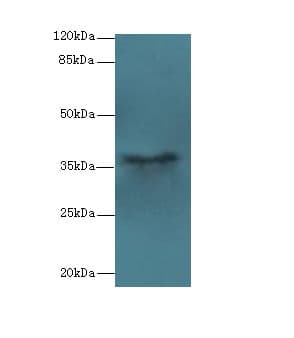 Polyclonal Rabbit anti-Human PSG11 Antibody (WB)