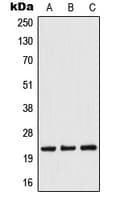 TWIST1 / TWIST Antibody (N-Terminus)