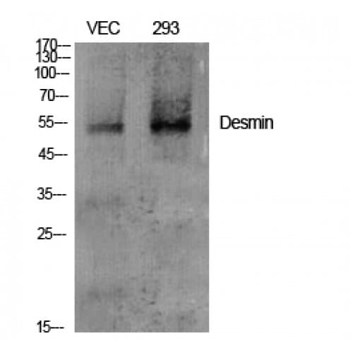 Polyclonal Rabbit anti-Human DES / Desmin Antibody (390-470 aa, C-terminal, IHC, IF, WB)