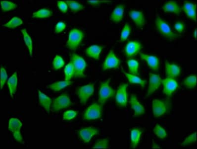 IHC-plus™ EIF4A2 Antibody (aa1-407)
