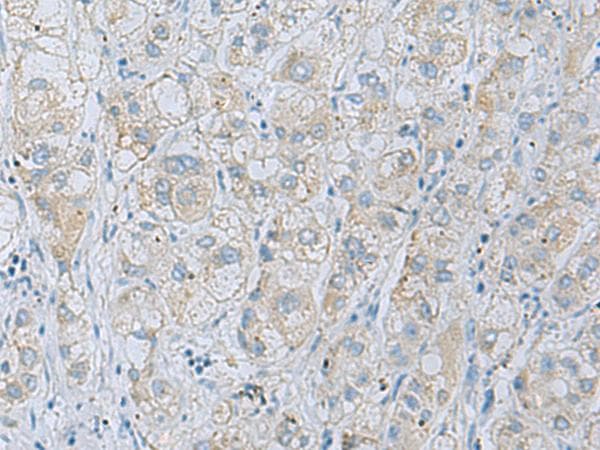 NAGK Antibody
