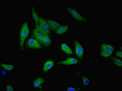 GALE / UDP-Glucose 4-Epimerase Antibody (aa1-348)