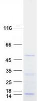 Human DDX39 Protein (Recombinant Myc-DDK (Flag))