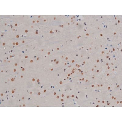 Polyclonal Rabbit anti-Human CHUK / IKKA / IKK Alpha Antibody (phospho-Ser180,phospho-Ser181, IHC, IF, WB)