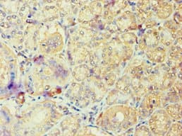 Polyclonal Rabbit anti-Human ARF6 Antibody (aa1-175, IHC, WB)
